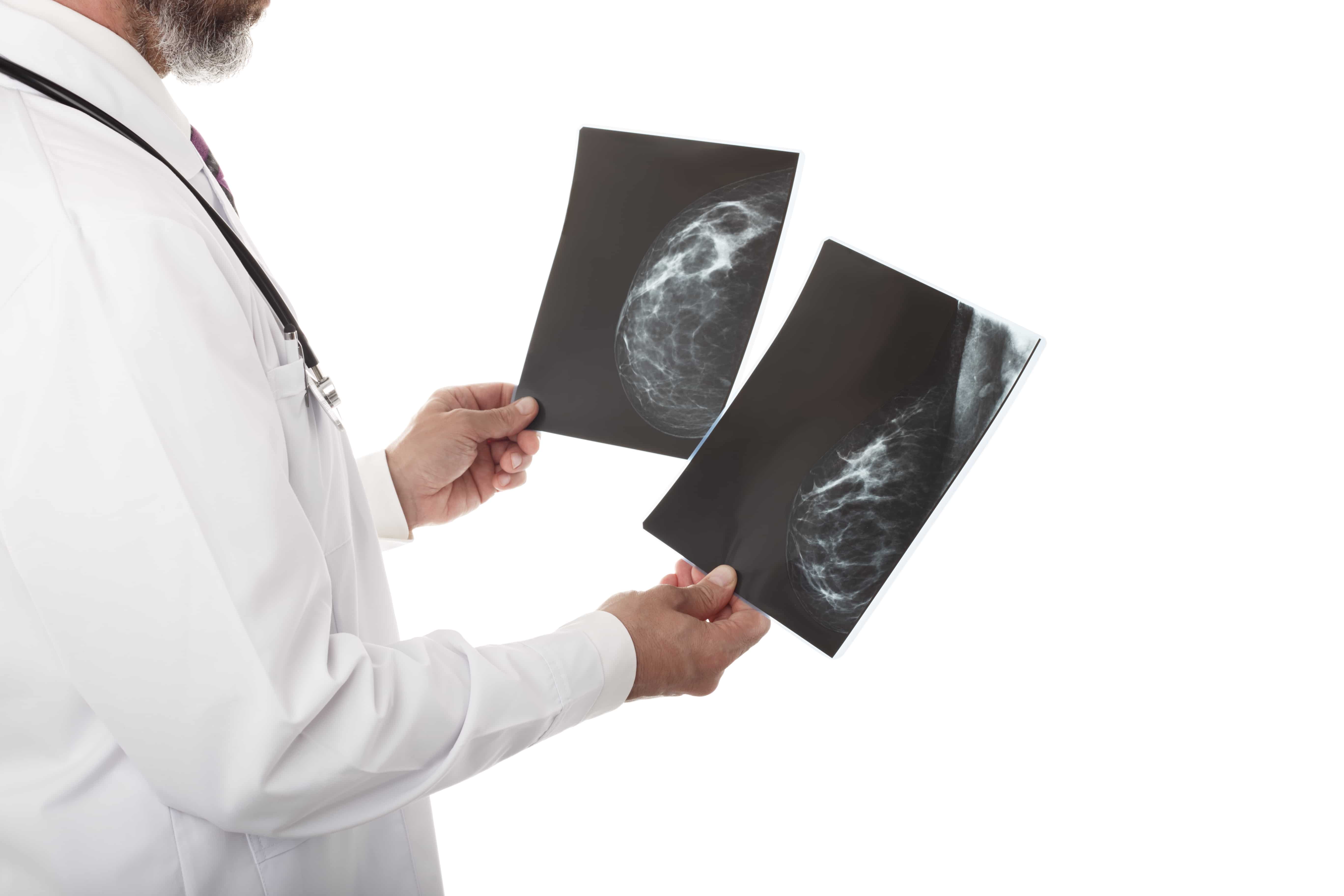 Mammogram